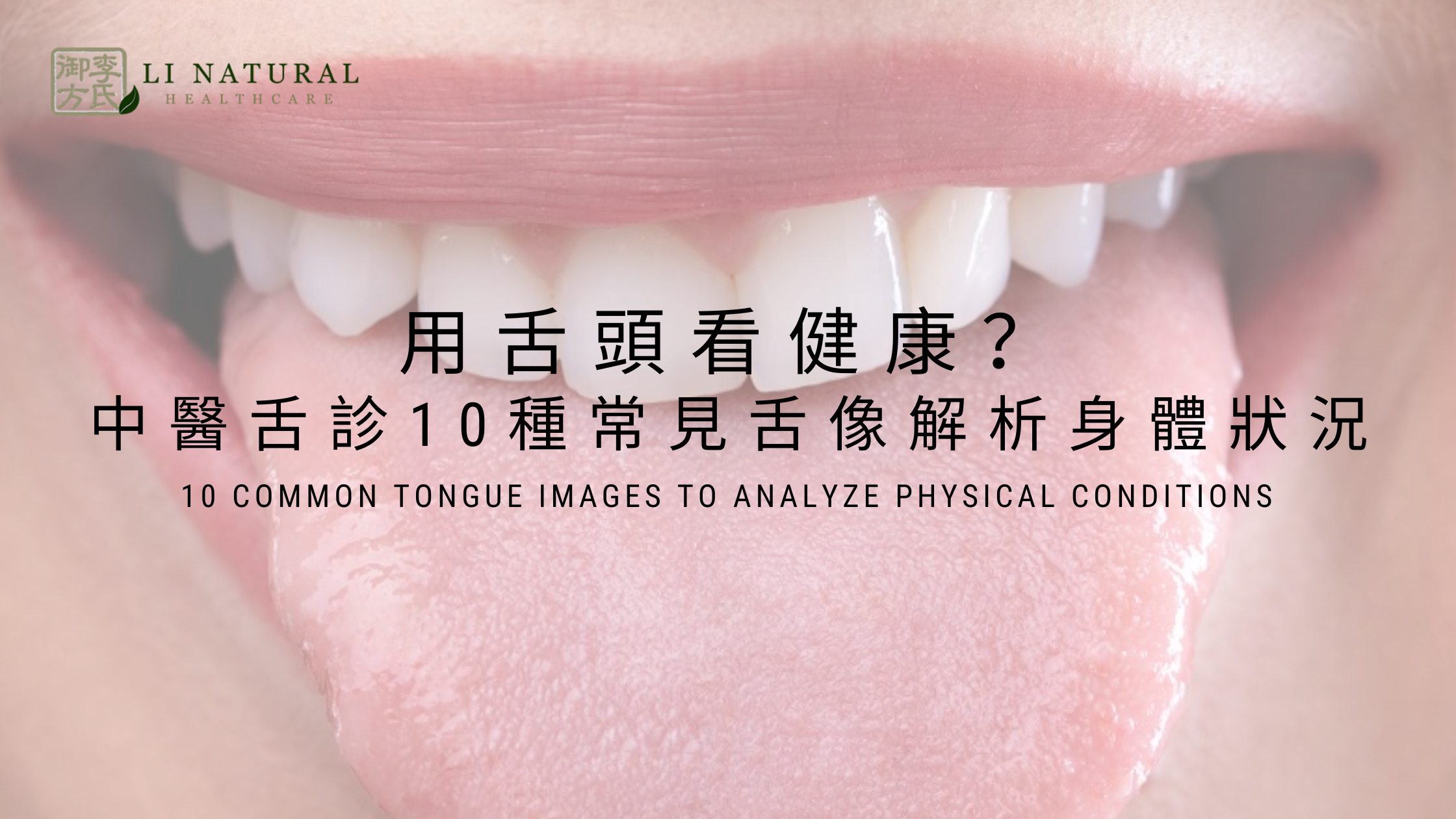用舌頭看健康?中醫舌診10種常見舌像解析身體狀況 + 【消除下肢水腫】6周的經絡運動挑戰 -之第五集 – Li Natural Healthcare
